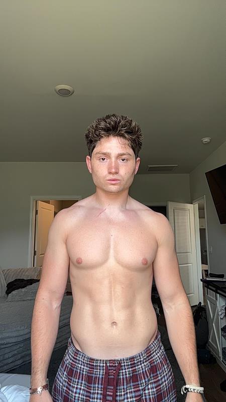 Cade G. — before