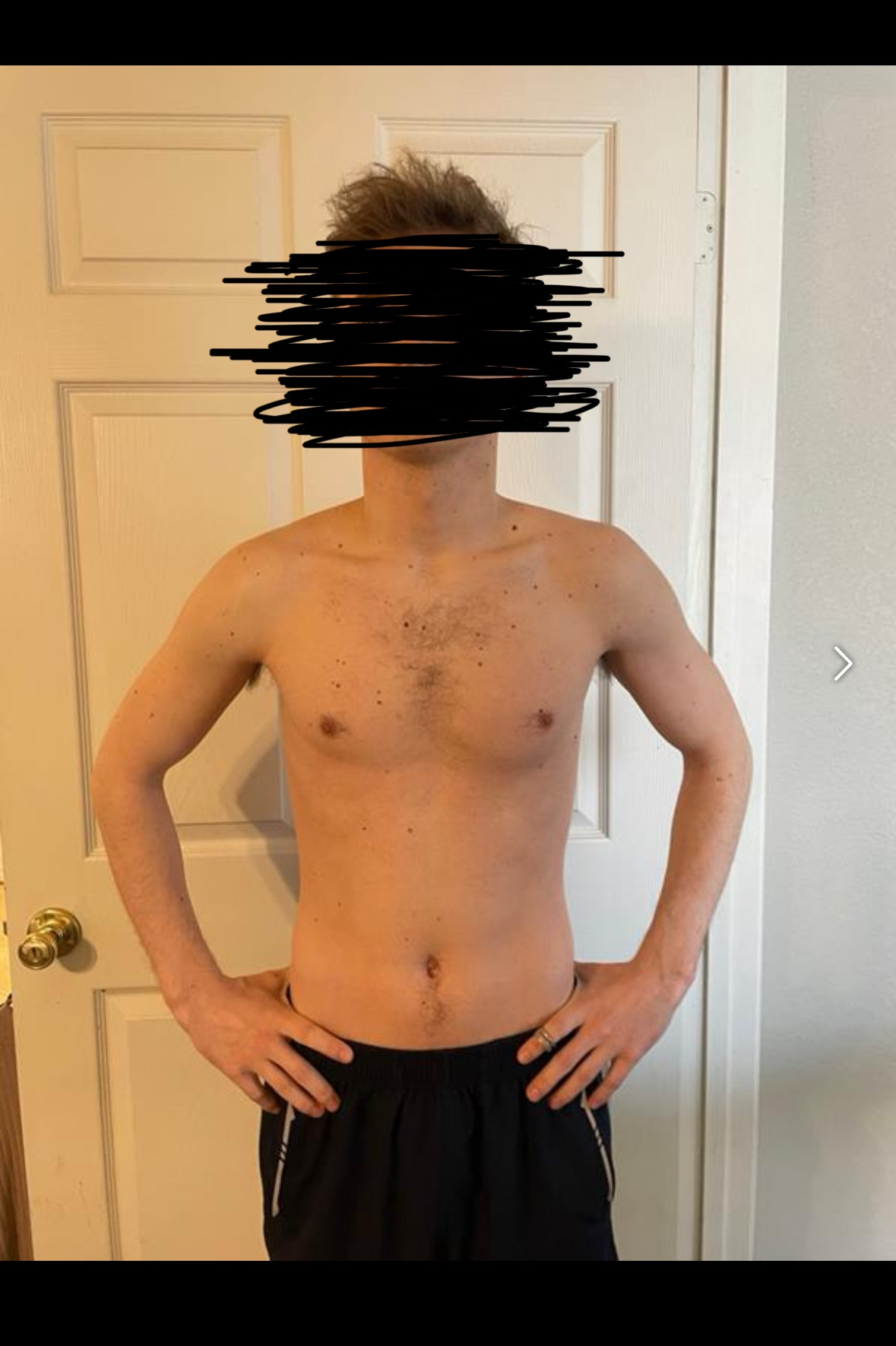 Cade N. — before